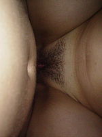 Photo 6, Rectal xxx